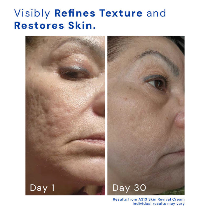 Retinol Gesichtscreme gegen Falten &amp; Unreinheiten | Glättet, verfeinert Poren &amp; unterstützt ebenmäßigen Teint | Für Abendroutine