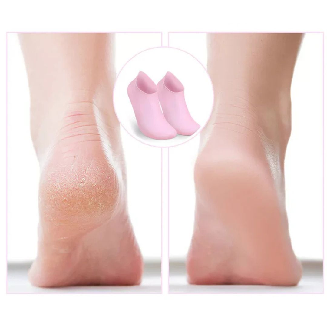 Feuchtigkeitsspendende Silikon-Pediküresocken 2 Paar | Für trockene &amp; raue Fersen | Unterstützt die Pflegewirkung von Cremes | Einheitsgröße US 5–10 | Rosa/Weiß