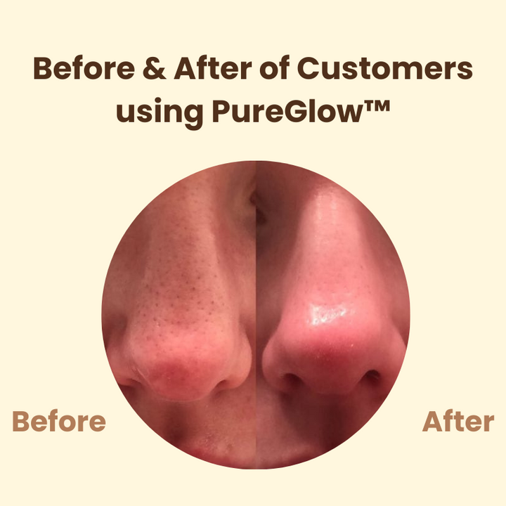 TeaFusionsMask™ Black tea mask