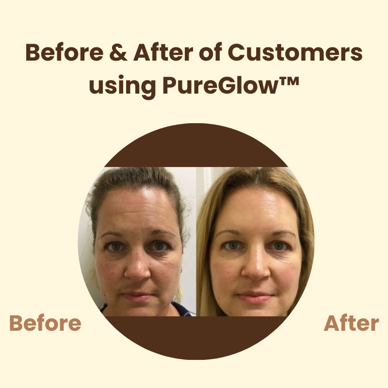 TeaFusionsMask™ Black tea mask