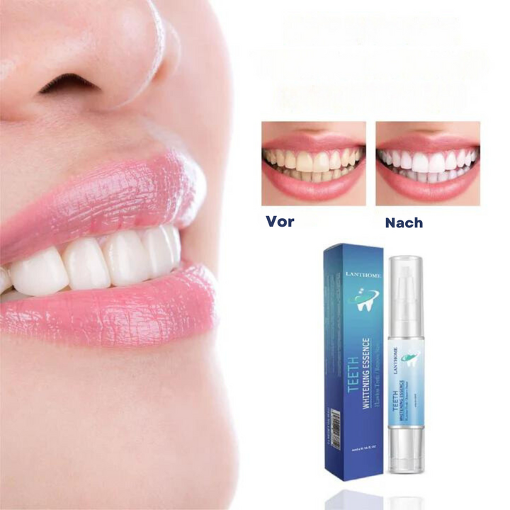 Teeth whitening kit for home &amp; travel | Reduces stains from coffee, tea &amp; more | Gentle on enamel | For a brighter smile