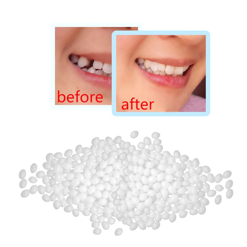 ToothFix™ DIY Tooth Repair Kit