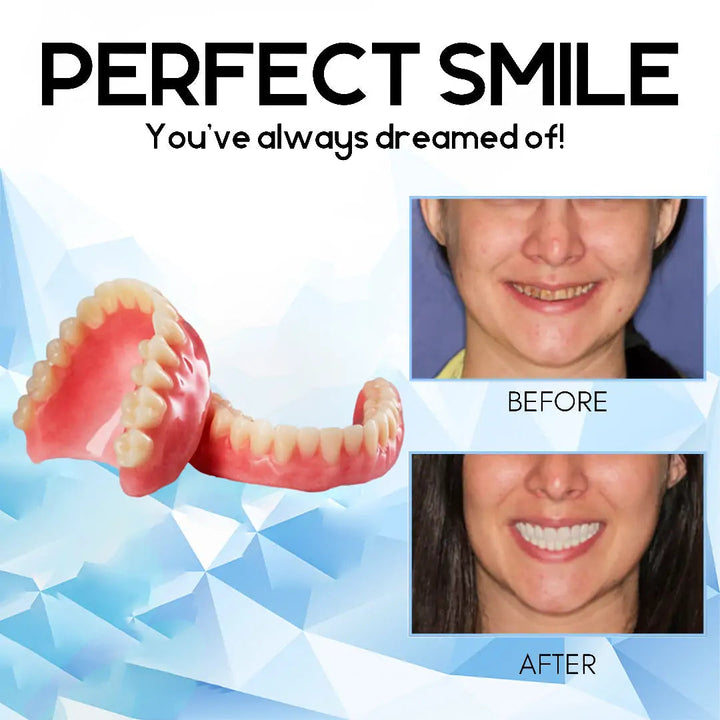 SmilePro™ – Hochwertiges, individuell angepasstes Silikon-Prothesenset