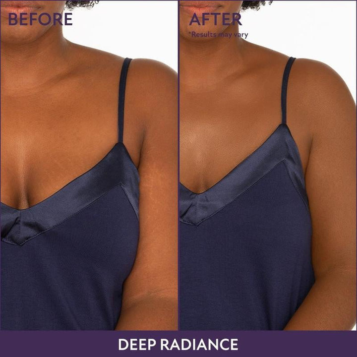 Complexion perfecter for body &amp; face | 24h coverage waterproof, sweatproof &amp; smudge-proof | Conceals scars/veins/tattoos | 6 shades