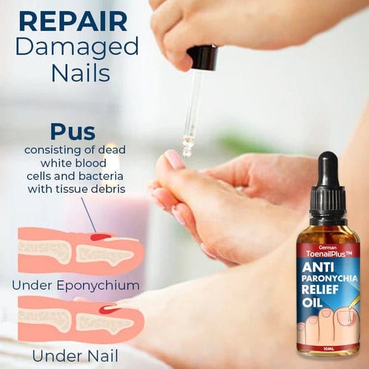 ToenailPlus™ Oil for relieving paronychia