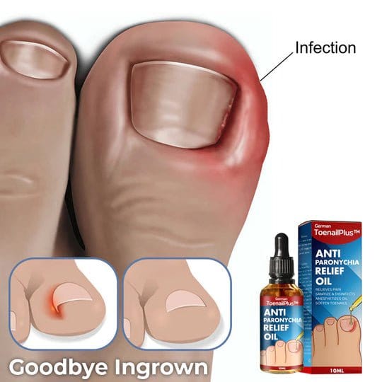 ToenailPlus™ Oil for relieving paronychia