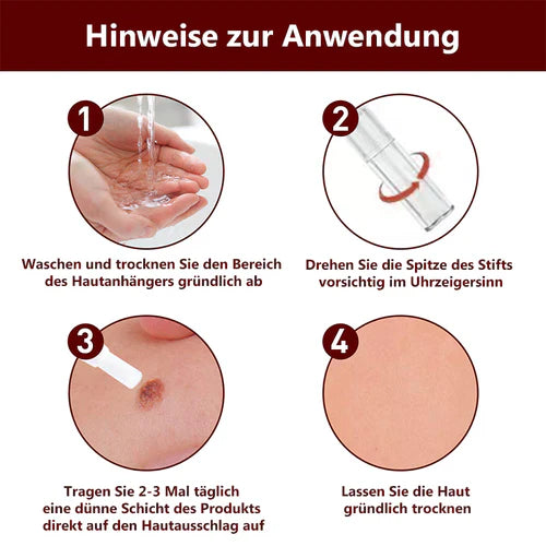 Hautanhängsel Entferner | Präzise Punkt-Anwendung | Glatter wirkende Haut | Für Hals, Achsel &amp; weitere Problemzonen