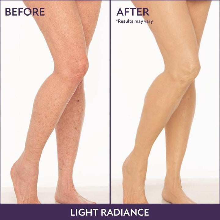 Complexion perfecter for body &amp; face | 24h coverage waterproof, sweatproof &amp; smudge-proof | Conceals scars/veins/tattoos | 6 shades
