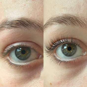 Eyelash serum with peptides &amp; biotin | For longer &amp; fuller looking lashes | Vegan, fragrance-free, for contact lenses, 1+1 free