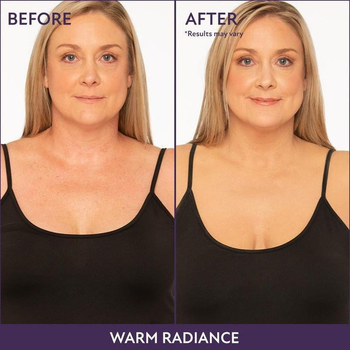 Complexion perfecter for body &amp; face | 24h coverage waterproof, sweatproof &amp; smudge-proof | Conceals scars/veins/tattoos | 6 shades