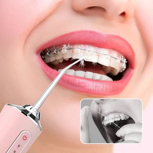 Szájzuhany vízflosser | 3 tisztítási mód + 1000 mAh akkumulátor | IPX7 vízálló | Fogszabályzóhoz és implantátumokhoz