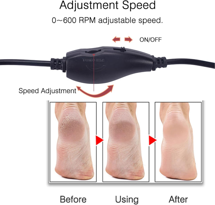 Electric foot callus remover | Pedicure tool with rotating discs + extra pads | USB connection | Smooth heels at home
