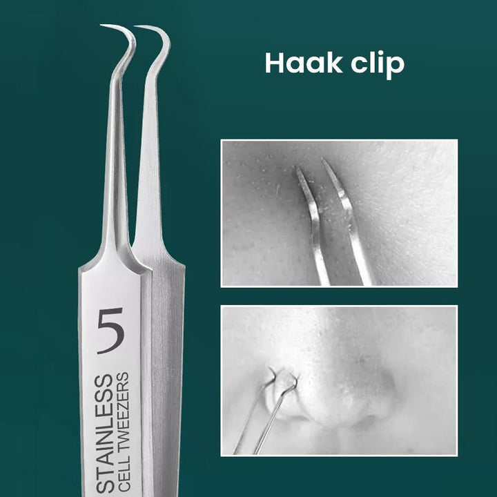 HautGreif™ Élimination ciblée des boutons