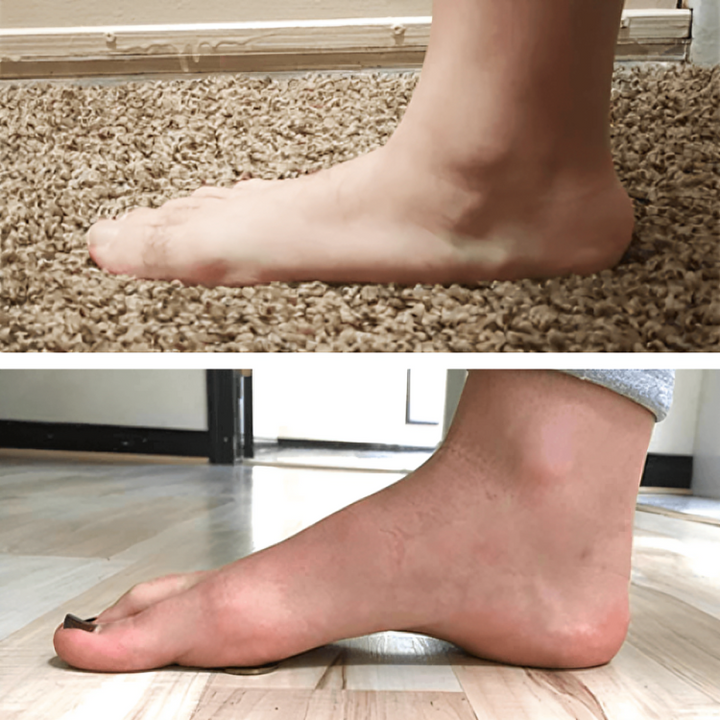 1+1 GRATUIT| Patchs anti-douleur™ soulagement immédiat des pieds