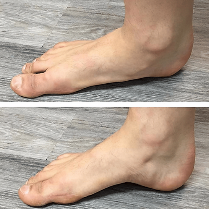 1+1 GRATUIT| Patchs anti-douleur™ soulagement immédiat des pieds