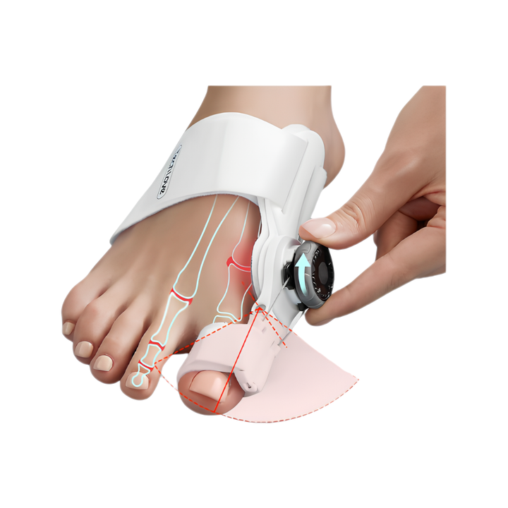 Zehenkorrektor für Hallux Valgus | Komfortabel &amp; Verstellbar | Sofortige Schmerzlinderung