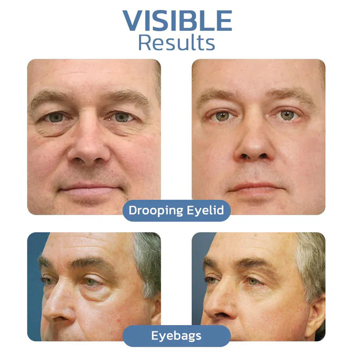 EyeRefresh™ Peptiditiiviste kiinteyttävälle silmägeelille