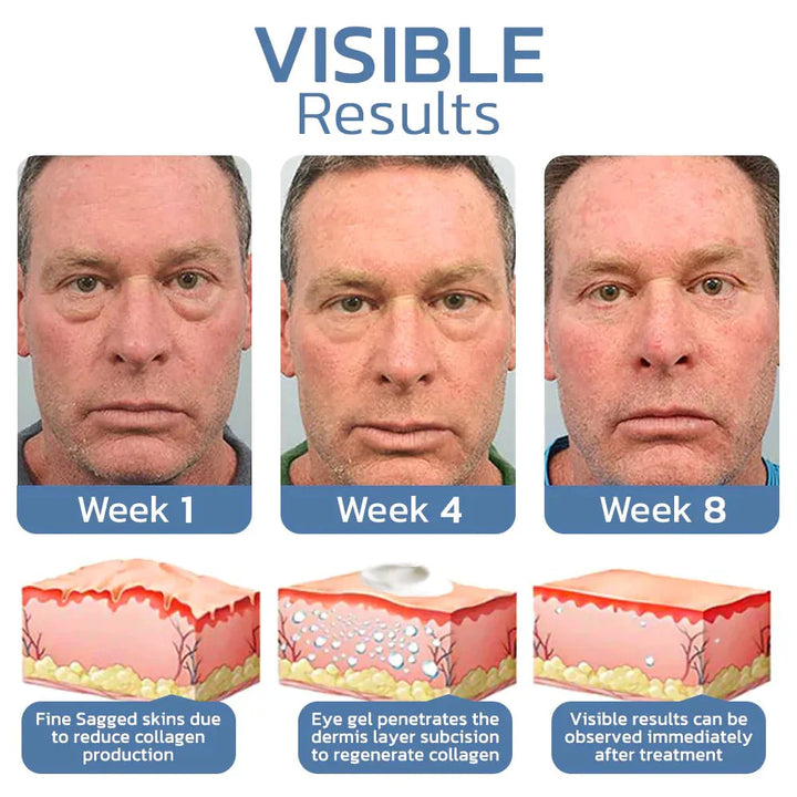 EyeRefresh™ Peptiditiiviste kiinteyttävälle silmägeelille