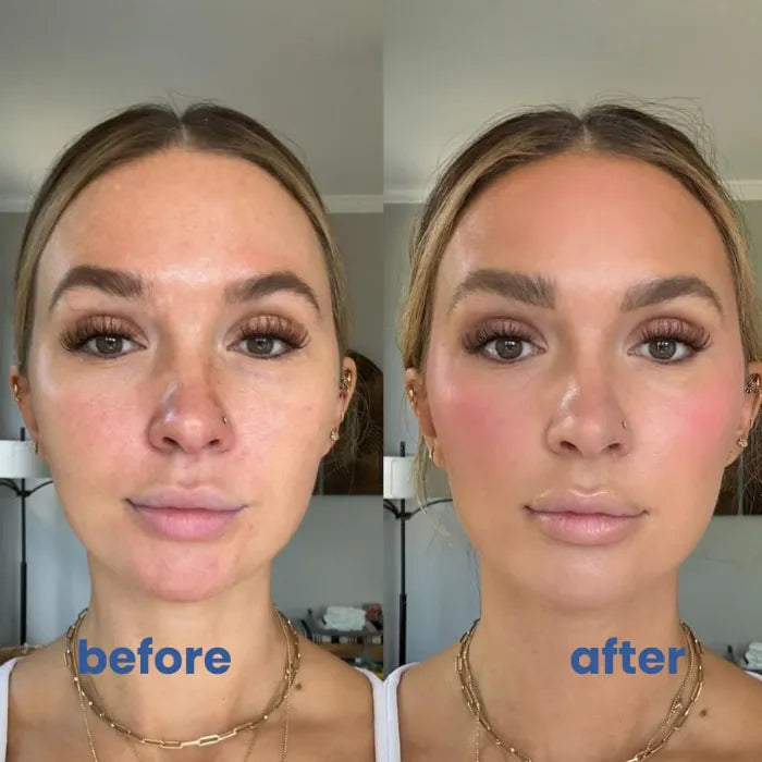 SkinMischung™ Neutralisiert sofortige Rötungen