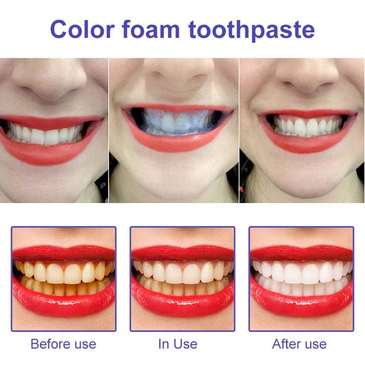 BrightenPro™ Ultimate Whitening Formula in Just a Few Weeks