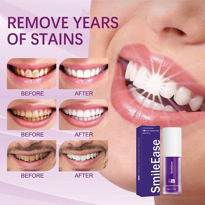 BrightenPro™ Ultimate Whitening Formula in Just a Few Weeks