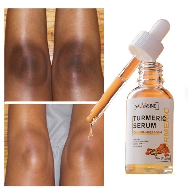 Kurkuma Serum gegen dunkle Flecken 30 ml | Mit Zitronenöl &amp; Olivenöl | Für ebenmäßiger wirkenden Teint &amp; Glow | Gesicht &amp; Körper